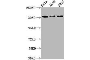 Western Blot Positive WB detected in: Hela whole cell lysate, A549 whole cell lysate, 293T whole cell lysate All lanes: MAN2B2 antibody at 1. (MAN2B2 抗体  (AA 347-523))