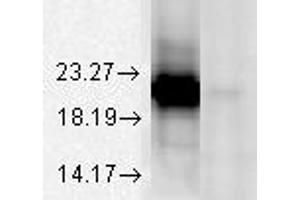 Alpha A Crystallin (1H3 B8), alphaA (L) and AlphaB (R) crystallin. (CRYAA 抗体)