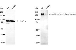 Western blotting analysis using epidermal growth factor receptor antibody (ABIN7798472).