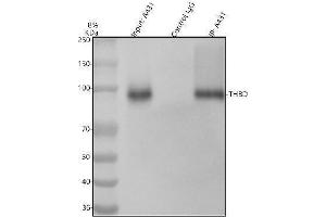 Immunoprecipitating Thrombomodulin/THBD in A431 whole cell lysate.