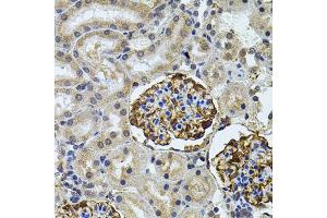 Immunohistochemistry of paraffin-embedded rat kidney using CETP antibody (ABIN5970634) (40x lens). (CETP 抗体)