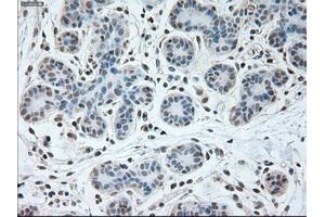 Immunohistochemical staining of paraffin-embedded breast tissue using anti-USP13 mouse monoclonal antibody. (USP13 抗体)