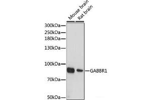 Western blot analysis of extracts of various cell lines using GABBR1 Polyclonal Antibody at dilution of 1:1000. (GABBR1 抗体)