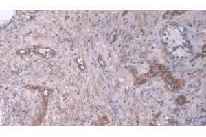 Immunohistochemistry (IHC) image for anti-Dual Specificity Phosphatase 6 (DUSP6) (AA 1-300) antibody (ABIN7436195)