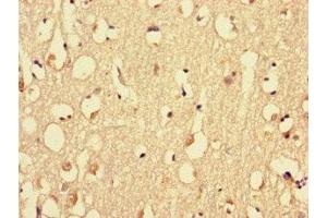 Immunohistochemistry of paraffin-embedded human brain tissue using ABIN7160576 at dilution of 1:100 (MYH3 抗体  (AA 1-217))