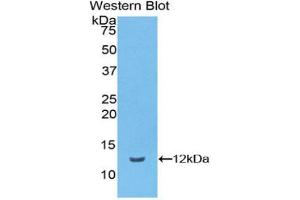 Western blot analysis of the recombinant protein. (Vitronectin 抗体  (AA 19-111))