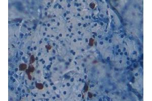 Immunohistochemistry (IHC) image for anti-KH Domain Containing, RNA Binding, Signal Transduction Associated 1 (KHDRBS1) (AA 156-381) antibody (ABIN7441811)