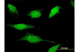 Immunofluorescence (IF) image for anti-Calcium/calmodulin-Dependent Protein Kinase ID (CAMK1D) (AA 1-95) antibody (ABIN528102)
