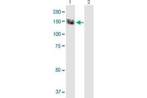 Western Blotting (WB) image for anti-Transient Receptor Potential Cation Channel, Subfamily C, Member 5 (TRPC5) (AA 1-973) antibody (ABIN521105)