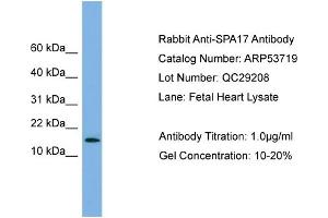 WB Suggested Anti-SPA17  Antibody Titration: 0. (SPA17 抗体  (N-Term))