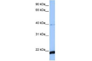 HBS1L antibody used at 1 ug/ml to detect target protein. (HBS1L 抗体)