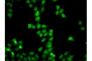 Immunofluorescence analysis of A549 cells using HDGFRP2 antibody. (HDGFRP2 抗体)