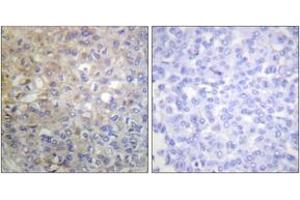 Immunohistochemistry (IHC) image for anti-Fibroblast Growth Factor Receptor 1 (FGFR1) (AA 736-785) antibody (ABIN1532336)