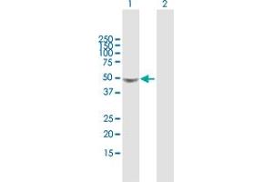 Western Blot analysis of GLA expression in transfected 293T cell line by GLA MaxPab polyclonal antibody. (GLA 抗体  (AA 1-429))
