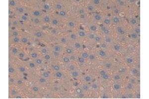 IHC-P analysis of Rat Liver Tissue, with DAB staining. (Haptoglobin 抗体  (AA 70-332))