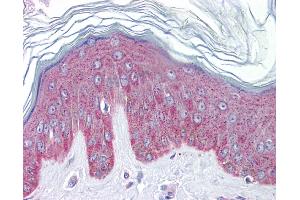 Immunohistochemistry (IHC) image for anti-Interleukin 33 (IL33) (N-Term) antibody (ABIN406152) (IL-33 抗体  (N-Term))