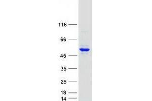 Western Blotting (WB) image for Phosphate Cytidylyltransferase 2, Ethanolamine (PCYT2) protein (Myc-DYKDDDDK Tag) (ABIN2728457)