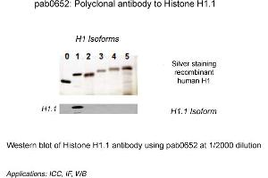 Image no. 1 for anti-Histone H1.1 (HIST1H1A) (N-Term) antibody (ABIN410162) (Histone H1.1 抗体  (N-Term))