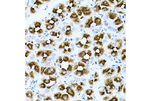 Immunohistochemistry of paraffin-embedded human stomach using DLK1 antibody. (DLK1 抗体  (AA 83-383))
