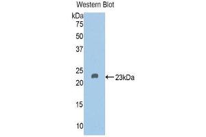 Western Blotting (WB) image for anti-Vitamin D-Binding Protein (GC) (AA 209-394) antibody (ABIN1858610) (Vitamin D-Binding Protein 抗体  (AA 209-394))