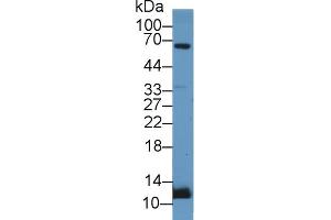 Detection of UCN2 in Rat Adrenal gland lysate using Polyclonal Antibody to Urocortin 2 (UCN2) (Urocortin 2 抗体  (AA 20-112))