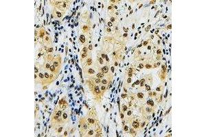Immunohistochemistry (IHC) image for anti-Inhibitor of DNA Binding 4, Dominant Negative Helix-Loop-Helix Protein (ID4) (N-Term) antibody (ABIN7303072)