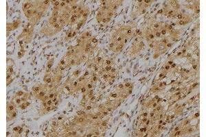 ABIN6276963 at 1/100 staining Human kidney tissue by IHC-P. (GLO1 抗体  (Internal Region))