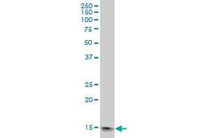 PFN1 polyclonal antibody (A01), Lot # Abnova060427QCS1 Western Blot analysis of PFN1 expression in HeLa . (PFN1 抗体  (AA 1-140))