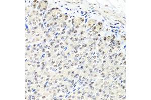 Immunohistochemistry of paraffin-embedded mouse stomach using CNOT8 antibody at dilution of 1:100 (x40 lens). (CNOT8 抗体)