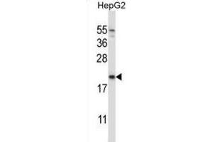 Western Blotting (WB) image for anti-NADH Dehydrogenase (Ubiquinone) 1 alpha Subcomplex, Assembly Factor 2 (NDUFAF2) antibody (ABIN2997290) (NDUFAF2 抗体)