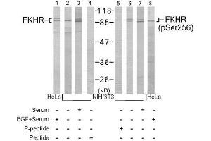 Image no. 1 for anti-Forkhead Box O1 (FOXO1) (pSer256) antibody (ABIN196813) (FOXO1 抗体  (pSer256))