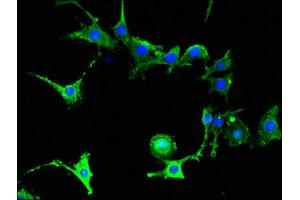 Immunofluorescent analysis of MCF-7 cells using ABIN7152652 at dilution of 1:100 and Alexa Fluor 488-congugated AffiniPure Goat Anti-Rabbit IgG(H+L) (FAAH 抗体  (AA 205-342))