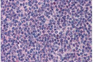 Human Spleen (formalin-fixed, paraffin-embedded) stained with PML antibody ABIN462187 followed by biotinylated goat anti-rabbit IgG secondary antibody ABIN481713, alkaline phosphatase-streptavidin and chromogen. (PML 抗体  (AA 588-637))