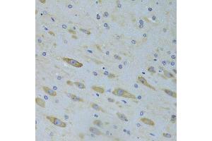 Immunohistochemistry of paraffin-embedded rat brain using SARS Antibody. (Seryl-tRNA Synthetase (SARS) (AA 1-300) 抗体)
