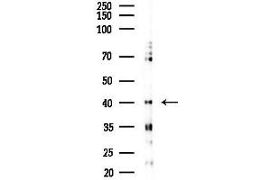 Western blot analysis of lysates from EC304 cells(starvation 24h treatment), using MYPOP Antibody at 1/1000 dilution.