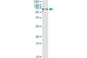 Western Blotting (WB) image for anti-Carboxylesterase 2 (CES2) (AA 514-621) antibody (ABIN563817)
