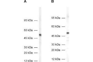 dilution: 1 : 1000, A: rat adrenal gland homogenate, B: mouse brain homogenate (DDC 抗体)