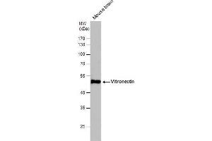 WB Image Vitronectin antibody detects Vitronectin protein by western blot analysis. (Vitronectin 抗体)