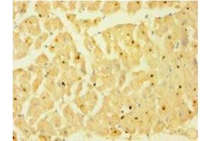 Immunohistochemistry of paraffin-embedded human heart tissue using ABIN7146925 at dilution of 1:100 (Caspase 1 抗体  (AA 120-269))