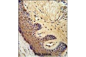 Formalin-fixed and paraffin-embedded human skin reacted with MC Antibody (Center), which was peroxidase-conjugated to the secondary antibody, followed by DAB staining. (MCAM 抗体  (AA 161-189))