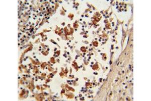 IHC analysis of FFPE human lymph tissue with BCL6 antibody (BCL6 抗体  (AA 519-547))