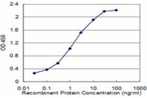 Detection limit for recombinant GST tagged LDLR is approximately 0. (LDLR 抗体  (AA 105-205))
