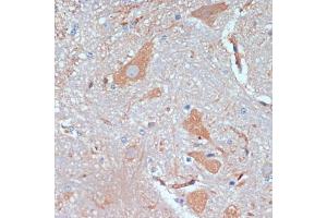 Immunohistochemistry (IHC) image for anti-Kinesin Family Member 5B (KIF5B) (AA 650-770) antibody (ABIN7268136)