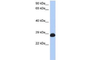 WB Suggested Anti-RAB39B Antibody Titration: 0. (RAB39B 抗体  (N-Term))