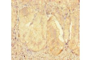 Immunohistochemistry of paraffin-embedded human adrenal gland tissue using ABIN7176128 at dilution of 1:100 (ZNF175 抗体  (AA 1-711))
