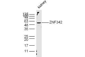 Mouse kidney lysates probed with ZNF342/ZNF296 Polyclonal Antibody, unconjugated  at 1:300 overnight at 4°C followed by a conjugated secondary antibody at 1:10000 for 60 minutes at 37°C. (Zinc Finger Protein 296 (ZNF296) (AA 231-350) 抗体)