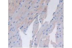 Detection of CD26 in Mouse Heart Tissue using Polyclonal Antibody to Cluster Of Differentiation 26 (CD26) (DPP4 抗体  (AA 29-178))