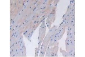 Detection of CD26 in Mouse Heart Tissue using Polyclonal Antibody to Cluster Of Differentiation 26 (CD26)
