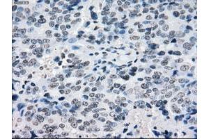Image no. 5 for anti-Crystallin, alpha B (CRYAB) antibody (ABIN1497647)