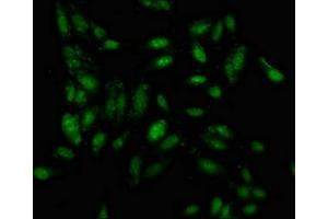 Immunofluorescence staining of Hela cells with ABIN7156618 at 1:100, counter-stained with DAPI. (IRF2BP1 抗体  (AA 340-499))